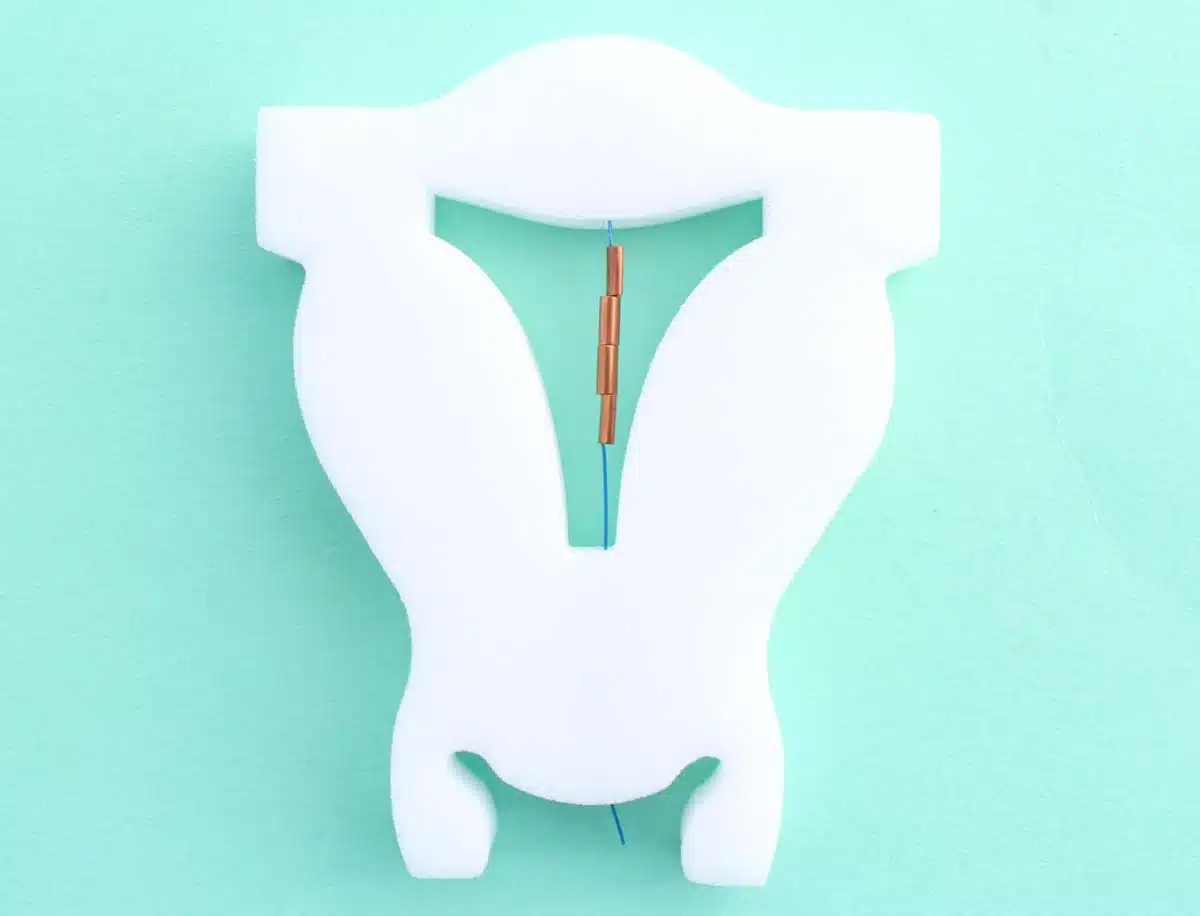 GyneFix 200 Kupferkette wird in einem Modell der Gebärmutter gezeigt