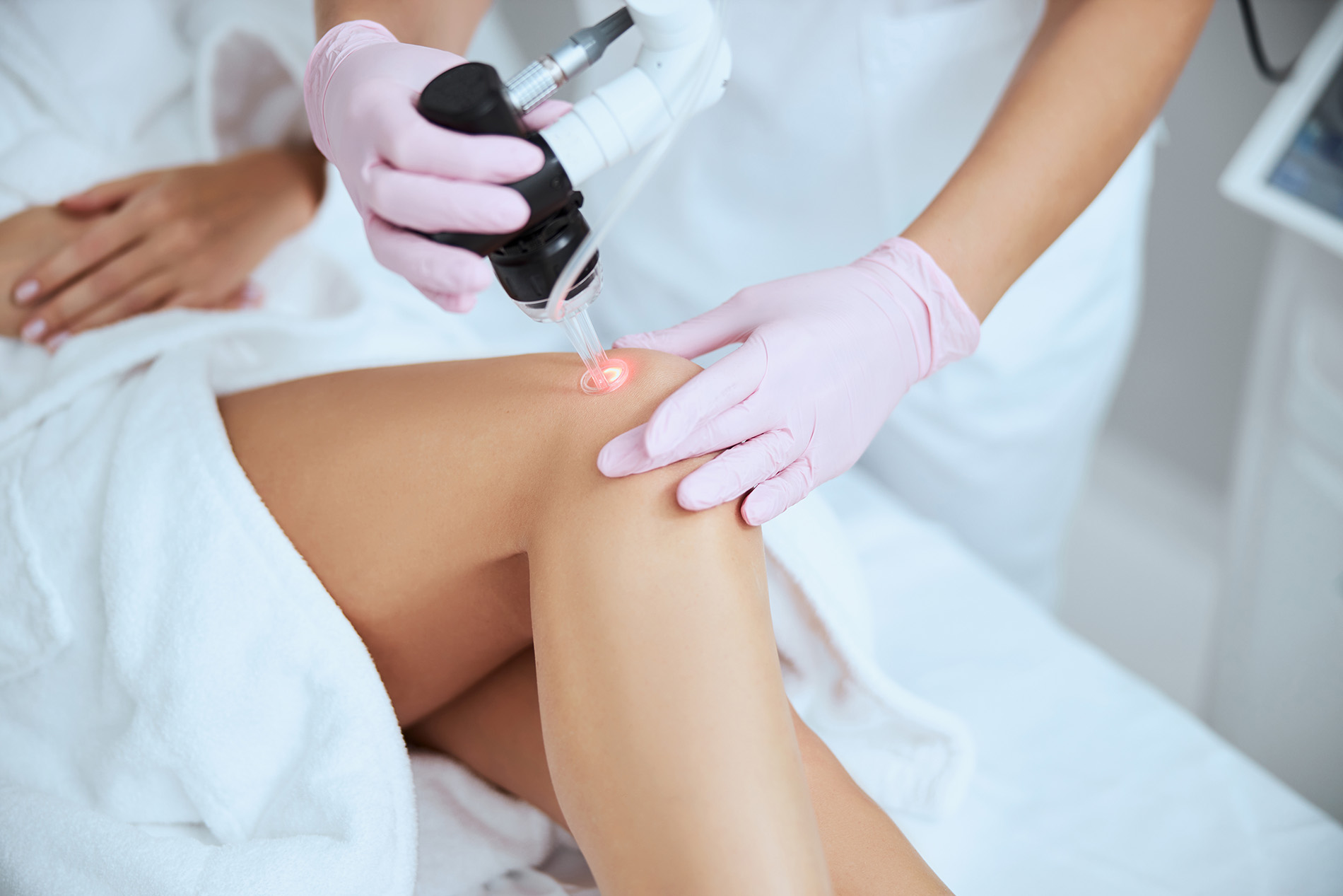 Dermatologin wendet Lasertherapie bei einem Bein einer Patientin an
